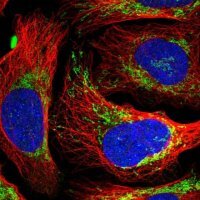 Anti-EVC2 antibody produced in rabbit 