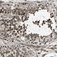ANTI-EXD2 antibody produced in rabbit 