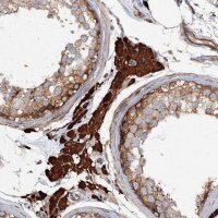 Anti-EXOC1 antibody produced in rabbit HPA037706-100UL