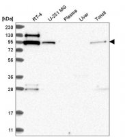 Anti-EXOC6B antibody produced in rabbit 
