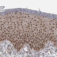 Anti-EXOSC1 antibody produced in rabbit HPA038370-100UL