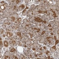 Anti-EXOSC10 antibody produced in rabbit 