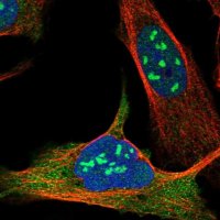 Anti-EXOSC10 antibody produced in rabbit 