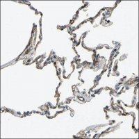 Anti-EZH1 antibody produced in rabbit HPA005478-100UL