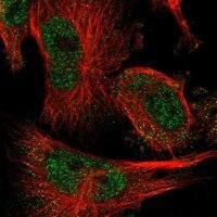 Anti-FAAP100 antibody produced in rabbit