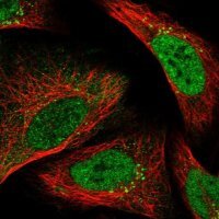 Anti-FAAP24 antibody produced in rabbit