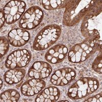 Anti-FAIM antibody produced in rabbit HPA052209-100UL