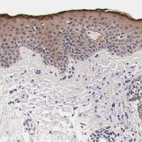 Anti-FAM109B antibody produced in rabbit 