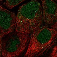 Anti-FAM110A antibody produced in rabbit 
