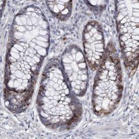 Anti-FAM111B antibody produced in rabbit 