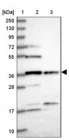 Anti-FAM118B antibody produced in rabbit 