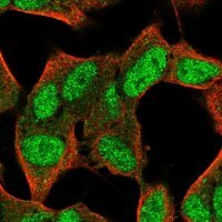 Anti-FAM124A antibody produced in rabbit