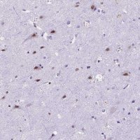 Anti-FAM124B antibody produced in rabbit 