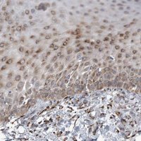 Anti-FAM160B2 antibody produced in rabbit 
