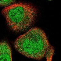 Anti-FAM160B2 antibody produced in rabbit 