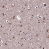 Anti-FAM181B antibody produced in rabbit