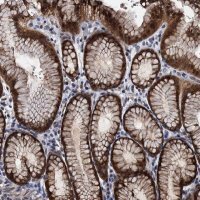 Anti-FAM222A antibody produced in rabbit 