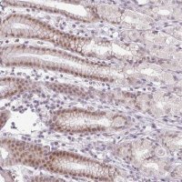 Anti-FAM65C antibody produced in rabbit 
