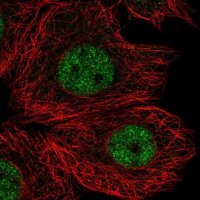 Anti-FAM65C antibody produced in rabbit 
