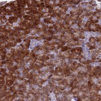 Anti-FAM84A antibody produced in rabbit HPA047703-100UL