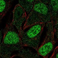 Anti-FAM84A antibody produced in rabbit HPA047703-100UL