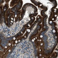 Anti-FAR1 antibody produced in rabbit 