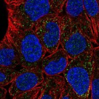 Anti-FAR1 antibody produced in rabbit 