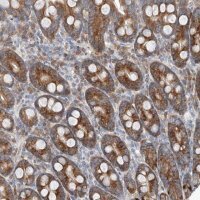 Anti-FASTK antibody produced in rabbit