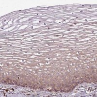 Anti-FAT4 antibody produced in rabbit 