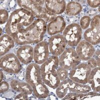 Anti-FBP1 antibody produced in rabbit 