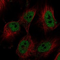Anti-FBRS antibody produced in rabbit 