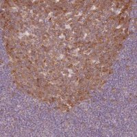 Anti-FBXL14 antibody produced in rabbit 