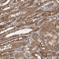 Anti-FBXL17 antibody produced in rabbit