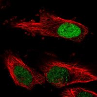 Anti-FBXL17 antibody produced in rabbit