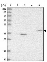 Anti-FBXL20 antibody produced in rabbit 