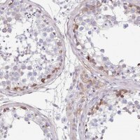 Anti-FBXL20 antibody produced in rabbit HPA050397-100UL
