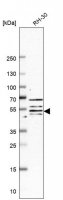Anti-FBXO3 antibody produced in rabbit HPA002467-100UL