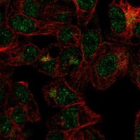 Anti-FBXO31 antibody produced in rabbit 