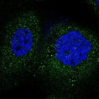 Anti-FBXO45 antibody produced in rabbit 
