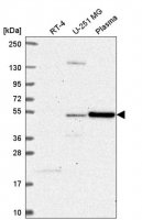 Anti-FBXO9 antibody produced in rabbit 