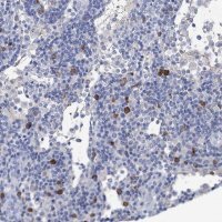 Anti-FBXW12 antibody produced in rabbit 