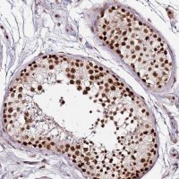 Anti-FCF1 antibody produced in rabbit 