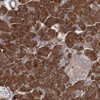 Anti-FERMT2 antibody produced in rabbit 