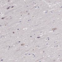 Anti-FGD1 antibody produced in rabbit 