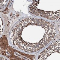 Anti-FGD4 antibody produced in rabbit 