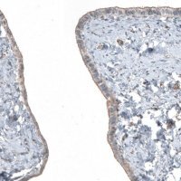Anti-FGFR2 antibody produced in rabbit 