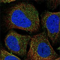Anti-FGFR2 antibody produced in rabbit HPA056562-100UL
