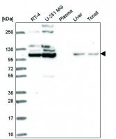 Anti-FGFR2 antibody produced in rabbit HPA056562-100UL