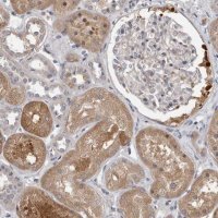 Anti-FGFR4 antibody produced in rabbit 