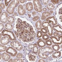 Anti-FIGNL1 antibody produced in rabbit 